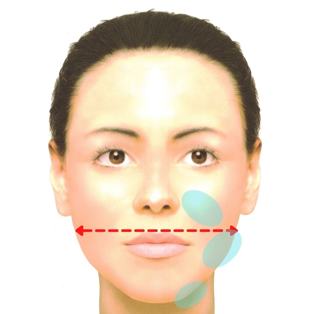 脂肪溶解注射と小顔 エラ ボトックス その違いは どちらが効果あるの 浦和駅1分の美容皮膚科 まぶたの治療 Ozi Skin Clinic